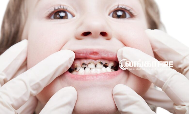 குழந்தைகளின், வாய், ஆரோக்கியம்